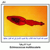   Echinococcus multilocularis